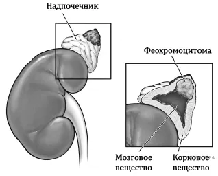 Рисунок к задаче